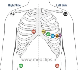 ekg lead locations