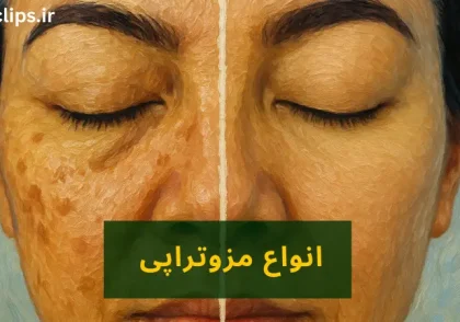 انواع مزوتراپی