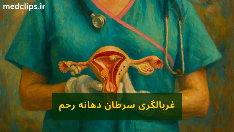 غربالگری سرطان دهانه رحم
