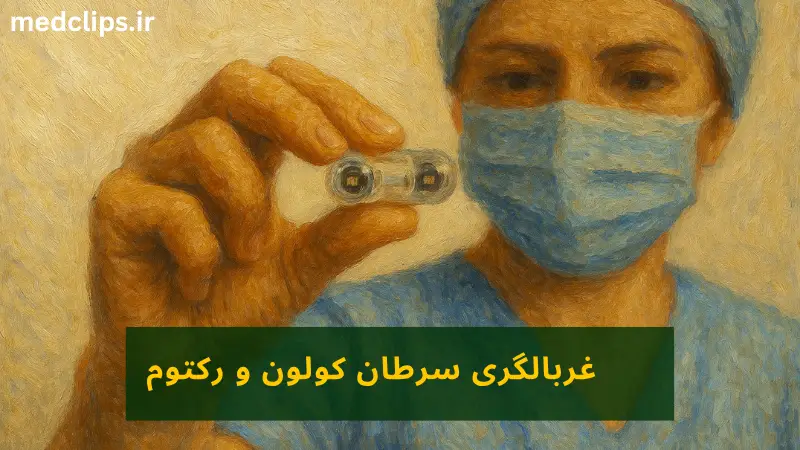غربالگری سرطان کولون و رکتوم