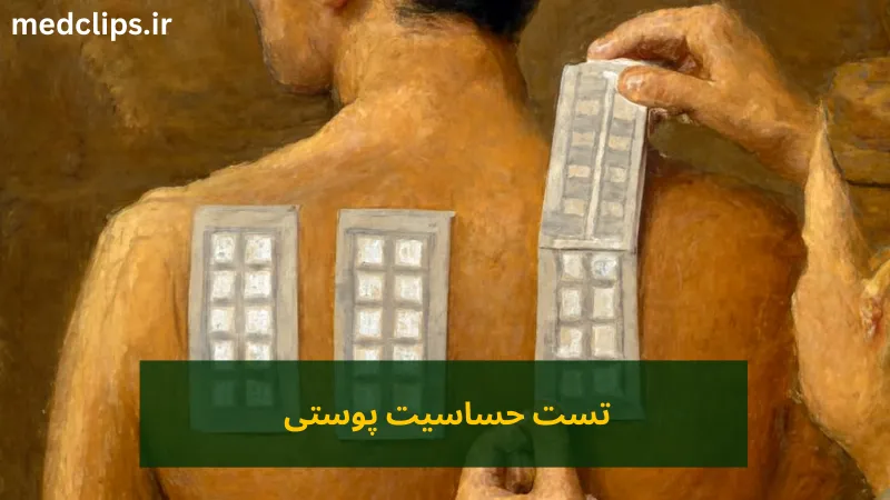 تست حساسیت پوستی