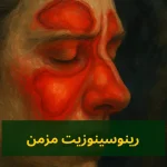 رینوسینوزیت مزمن