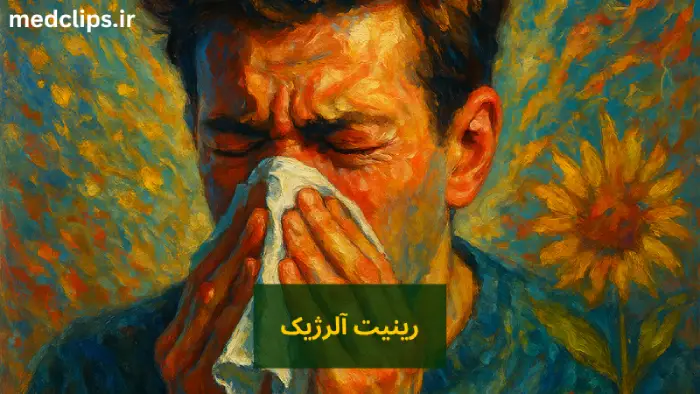 رینیت آلرژیک