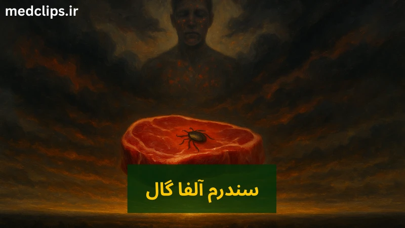 سندرم آلفا گال