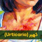 کهیر چیست