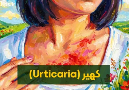 کهیر چیست