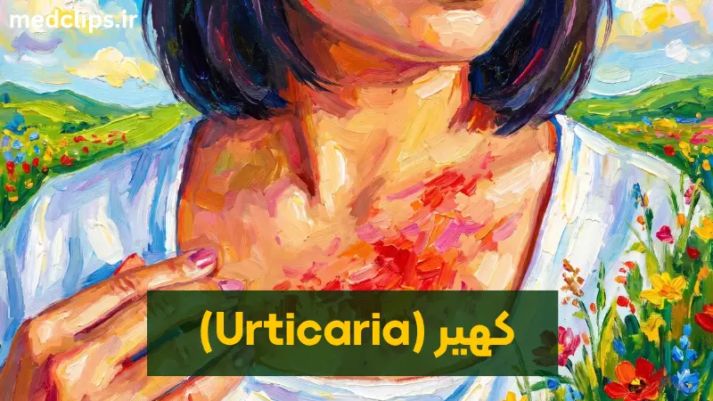 کهیر چیست